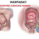 Illustration for article titled Obat Kencing Nanah Herbal Paling Ampuh Teruji Manjur Di Tangerang